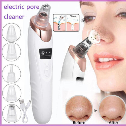 Electric Blackheads Remover